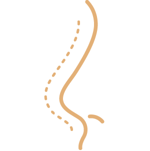 Mamoplastia Redutora